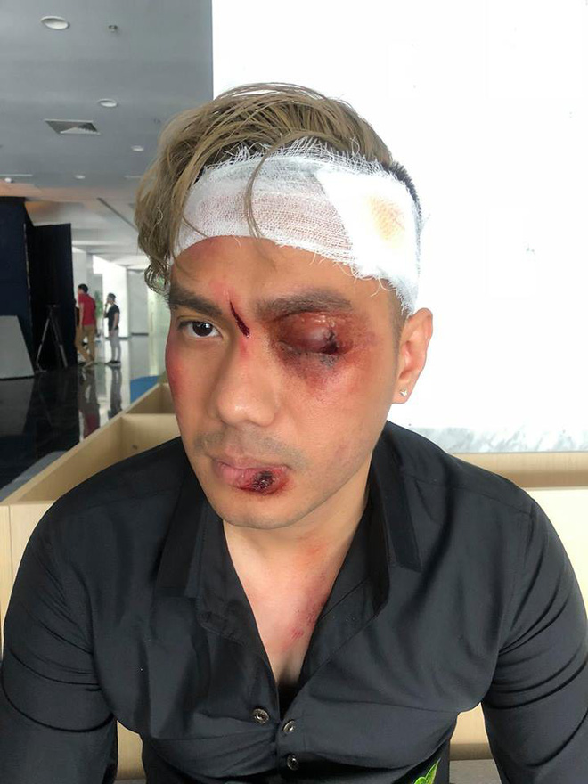 Người phán xử phần 2: Sợ hãi trước cảnh mù mắt của Thế Chột thời trẻ